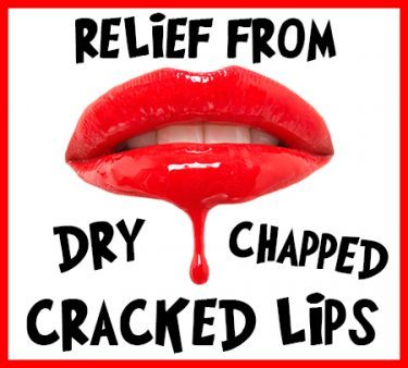 Cracked Lips e1483118077118