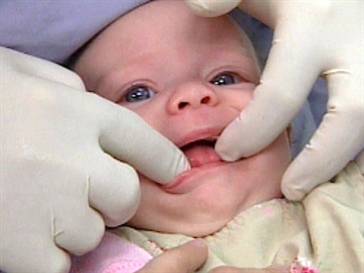 baby at dentist