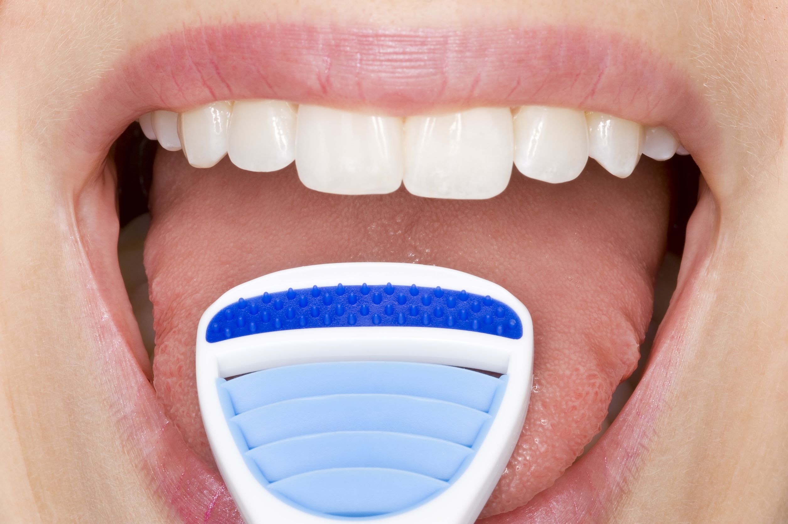 Tongue, dental health, oral health 